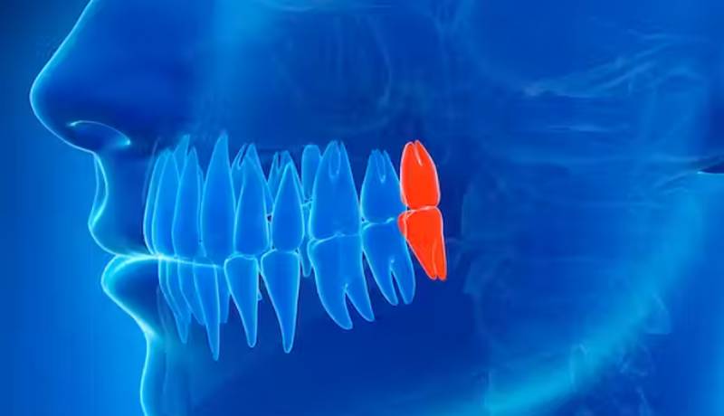 چرا ما انسان‌ها دندان عقل داریم؟
