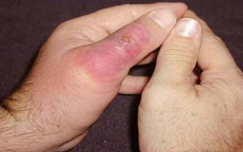 عقرب‌گزیدگی در کمین مردم رودبار جنوب | ثبت ۶۰ مورد گزش در فروردین