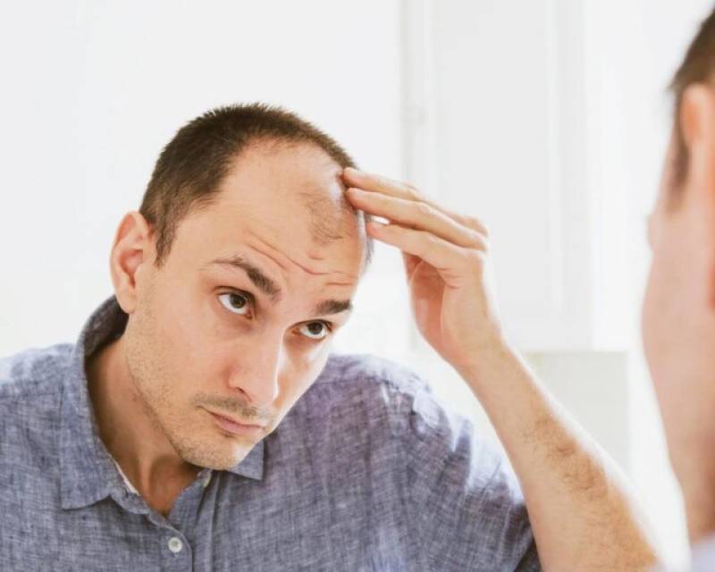 چند باور نادرست درباره ریزش مو